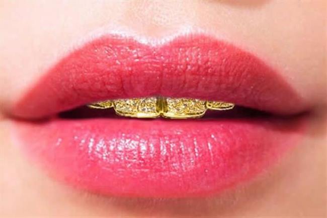 WTFSG_dental-jewelry-gold-and-diamond-dentures_2